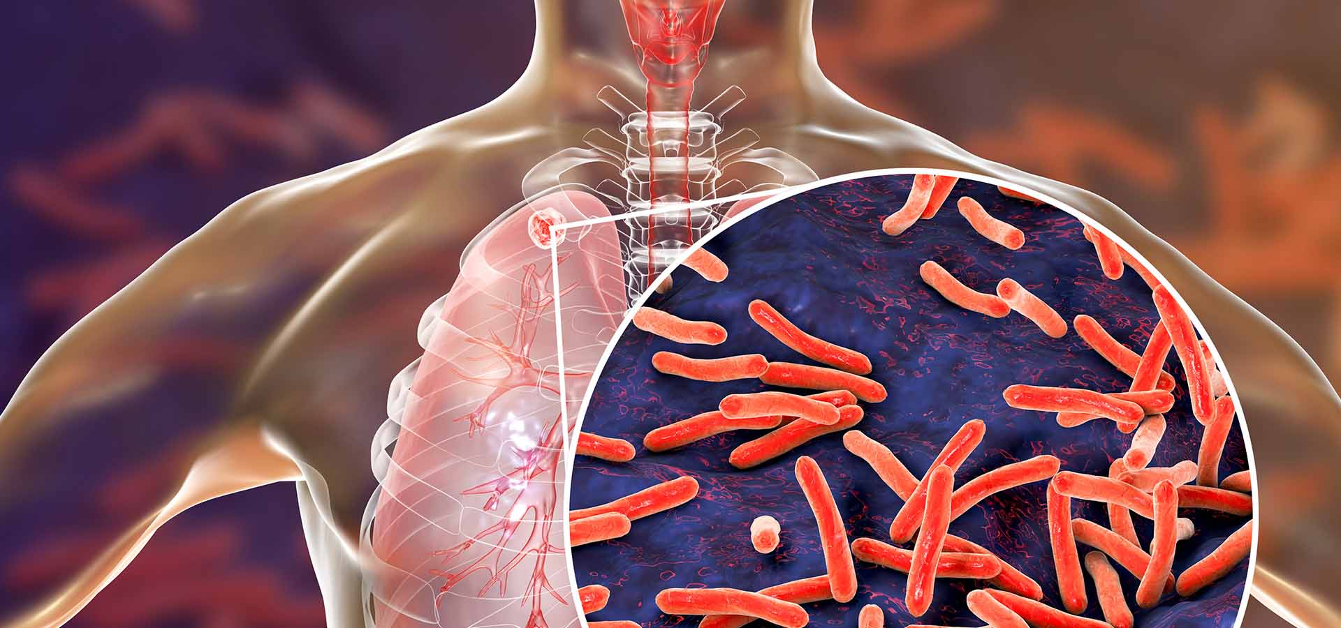 Transforming Tuberculosis Testing in Africa: Lasec® and RAL Diagnostics' Partnership